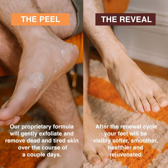 Feets Foot Peel Mask - 2 pack - Picture 2 of 3